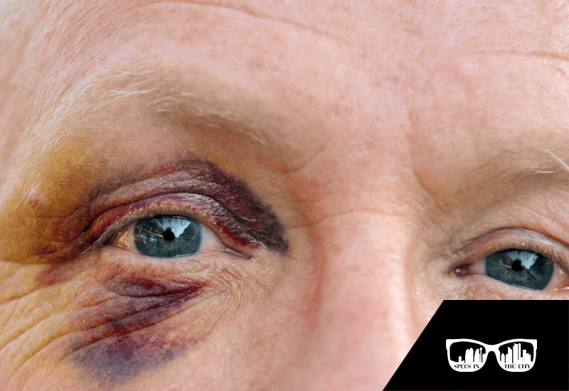 Eye Injury Prevention Month The Most Common Eye Injuries For Seniors And How To Prevent Them